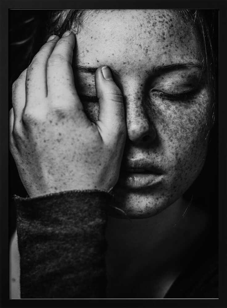 Pensive Freckled Face Art Print UK — Dark Moody Dark Wall Art — Living Room — Wall It All Prints